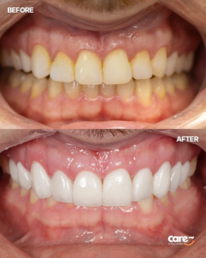 Slider image (5) Care Smile Center